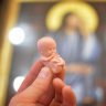 православный абортарий