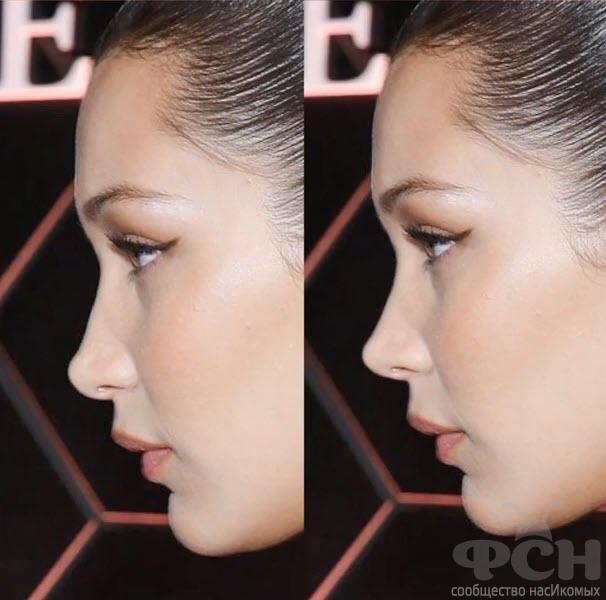 Dr. Bader NOSE Hollywood, episode 3- Bella Hadid.mp4_snapshot_01.36_[2022.09.21_19.15.34].jpg